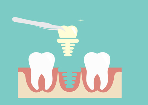 拔牙有哪些危害 拔牙的并發(fā)癥介紹