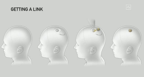 馬斯克的“腦機(jī)”到底是干什么的